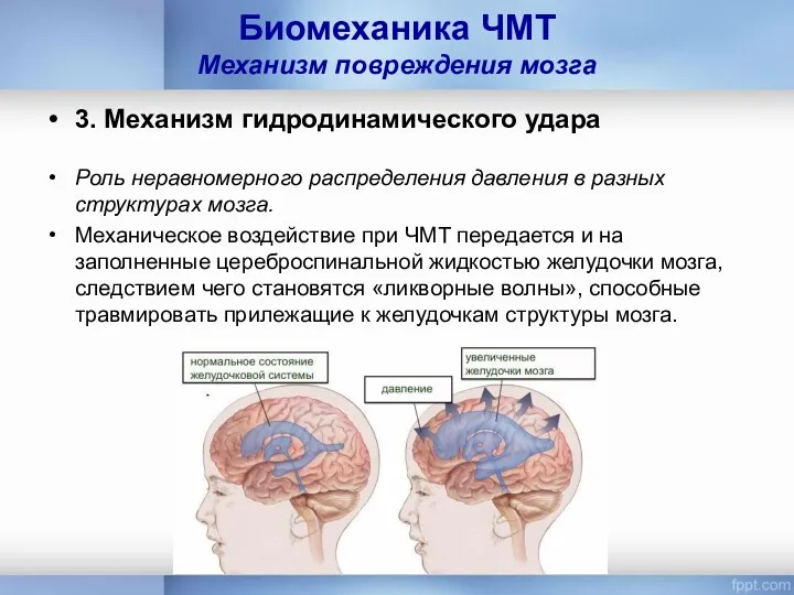 Биомеханика ЧМТ Механизм повреждения мозга 3. Механизм гидродинамического удара Роль