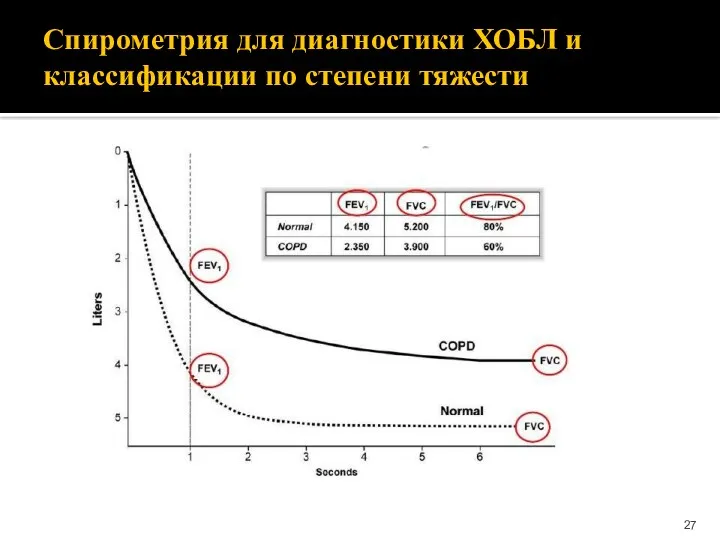 Спирометрия для диагностики ХОБЛ и классификации по степени тяжести