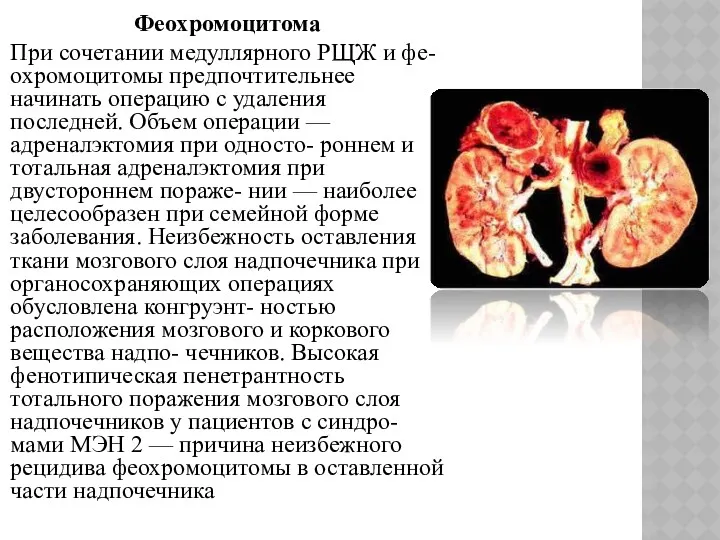 Феохромоцитома При сочетании медуллярного РЩЖ и фе- охромоцитомы предпочтительнее начинать