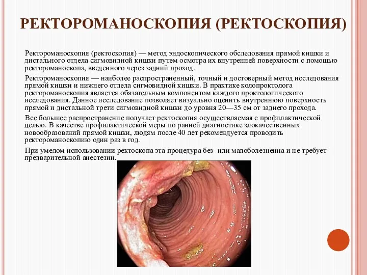 РЕКТОРОМАНОСКОПИЯ (РЕКТОСКОПИЯ) Ректороманоскопия (ректоскопия) — метод эндоскопического обследования прямой кишки и дистального отдела