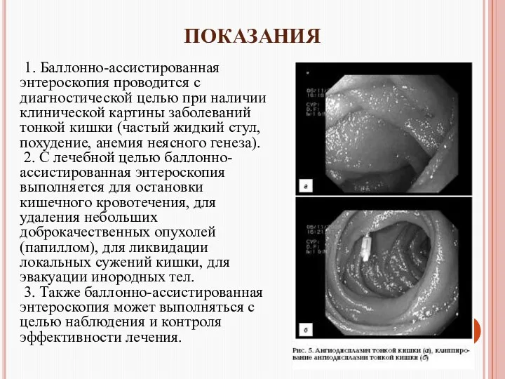 ПОКАЗАНИЯ 1. Баллонно-ассистированная энтероскопия проводится с диагностической целью при наличии