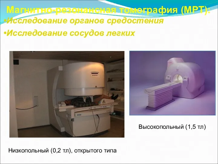 Магнитно-резонансная томография (МРТ): Исследование органов средостения Исследование сосудов легких Низкопольный (0,2 тл), открытого
