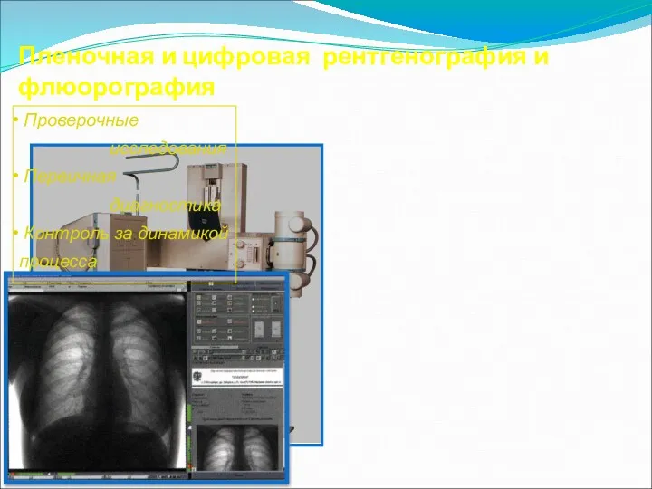 Пленочная и цифровая рентгенография и флюорография Проверочные исследования Первичная диагностика Контроль за динамикой процесса