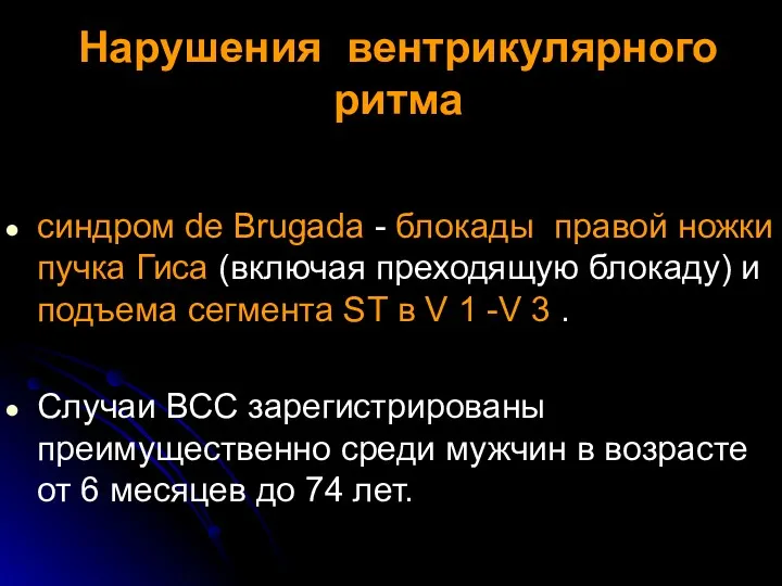 Нарушения вентрикулярного ритма синдром de Brugada - блокады правой ножки пучка Гиса (включая