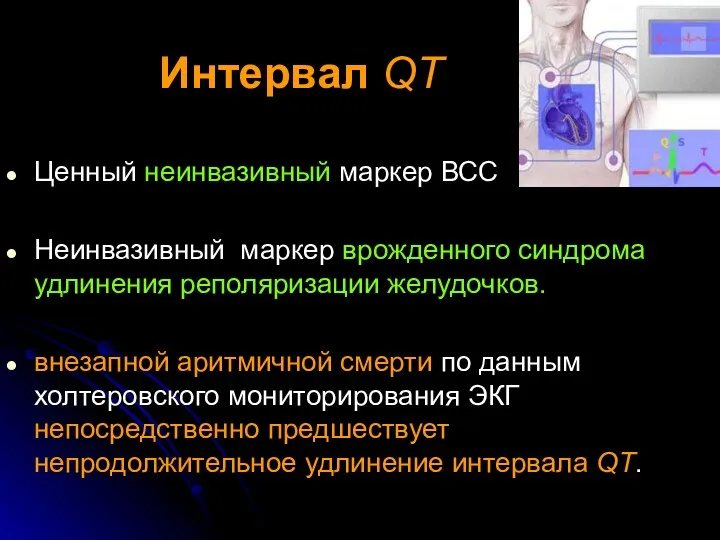 Интервал QT Ценный неинвазивный маркер ВСС Неинвазивный маркер врожденного синдрома