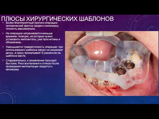 ПЛЮСЫ ХИРУРГИЧЕСКИХ ШАБЛОНОВ Более благоприятный прогноз операции: человеческий фактор сведен