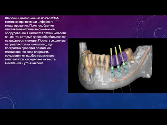 Шаблоны, выполненные по CAD/CAM-методике при помощи цифрового моделирования. Приспособления изготавливаются