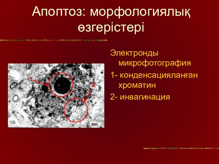 Апоптоз: морфологиялық өзгерістері Электронды микрофотография 1- конденсацияланған хроматин 2- инвагинация 2 1