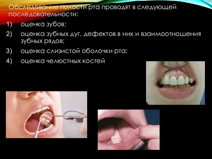 Обследование полости рта проводят в следующей последовательности: оценка зубов; оценка зубных дуг, дефектов