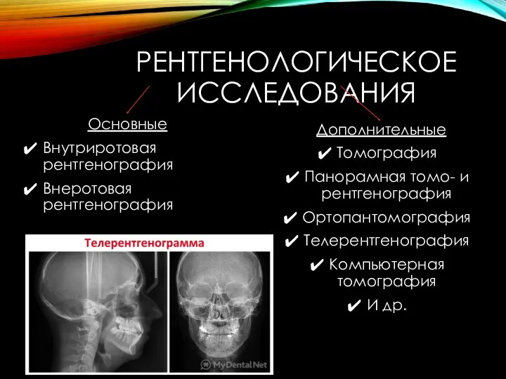 РЕНТГЕНОЛОГИЧЕСКОЕ ИССЛЕДОВАНИЯ Основные Внутриротовая рентгенография Внеротовая рентгенография Дополнительные Томография Панорамная