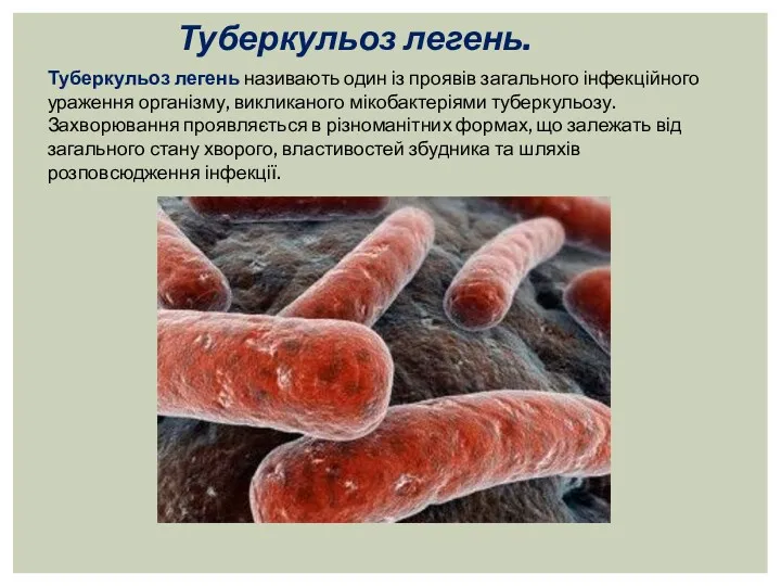 Туберкульоз легень. Туберкульоз легень називають один із проявів загального інфекційного