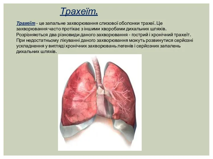 Трахеїт. Трахеїт - це запальне захворювання слизової оболонки трахеї. Це