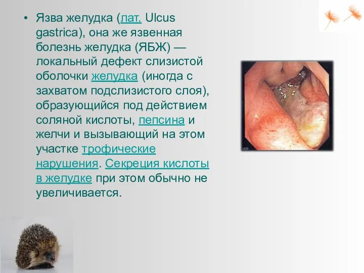 Язва желудка (лат. Ulcus gastrica), она же язвенная болезнь желудка