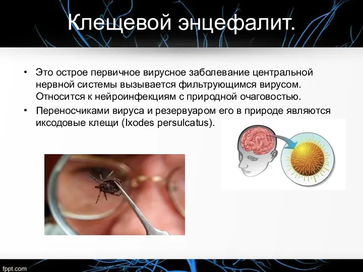 Клещевой энцефалит. Это острое первичное вирусное заболевание центральной нервной системы