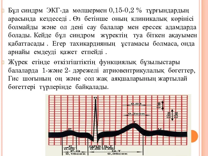 Бұл синдрм ЭКГ-да мөлшермен 0,15-0,2 % тұрғындардың арасында кездеседі .