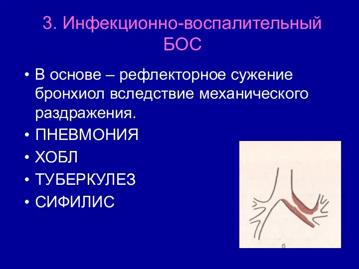 3. Инфекционно-воспалительный БОС В основе – рефлекторное сужение бронхиол вследствие механического раздражения. ПНЕВМОНИЯ ХОБЛ ТУБЕРКУЛЕЗ СИФИЛИС