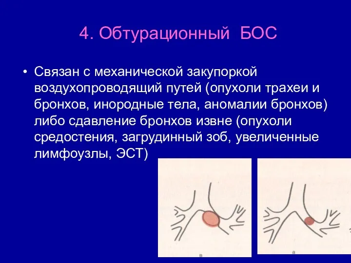 4. Обтурационный БОС Связан с механической закупоркой воздухопроводящий путей (опухоли трахеи и бронхов,