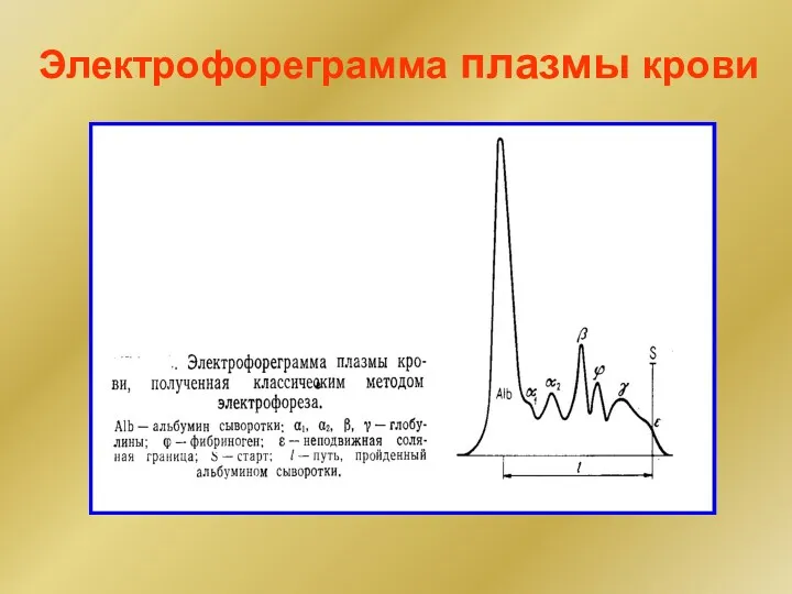 Электрофореграмма плазмы крови