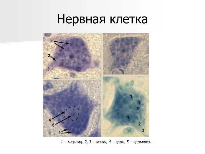 1 – тигроид, 2, 3 – аксон, 4 – ядро, 5 – ядрышко. Нервная клетка