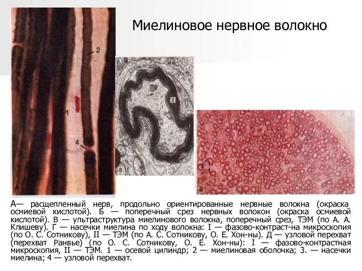 А— расщепленный нерв, продольно ориентированные нервные волокна (окраска осмиевой кислотой).
