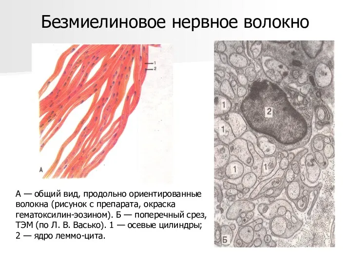 А — общий вид, продольно ориентированные волокна (рисунок с препарата,