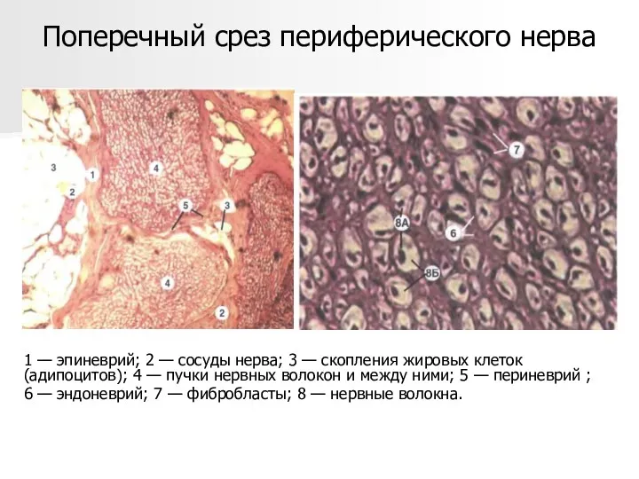 Поперечный срез периферического нерва 1 — эпиневрий; 2 — сосуды