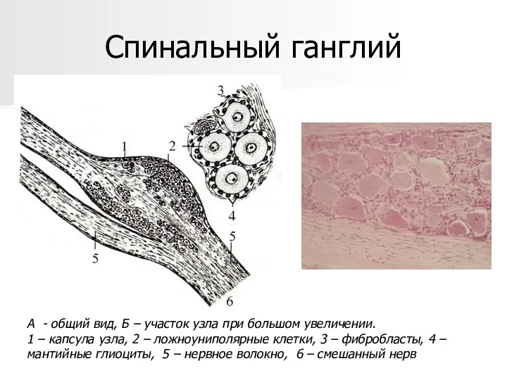 Спинальный ганглий А - общий вид, Б – участок узла