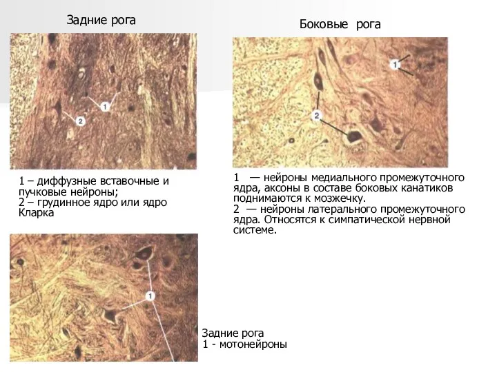 Задние рога Боковые рога Задние рога 1 - мотонейроны 1