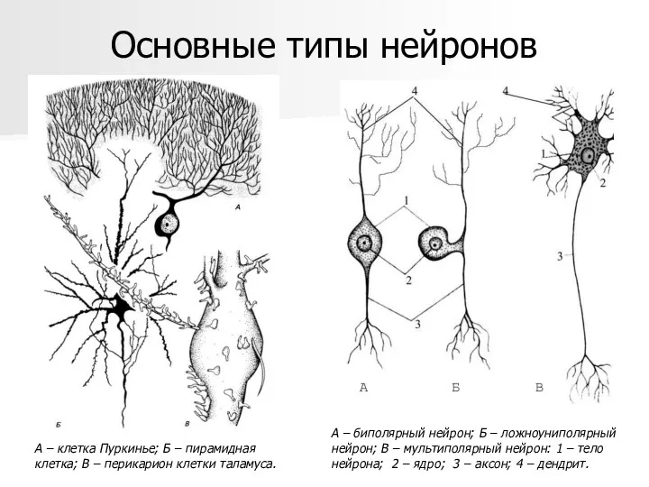 А – биполярный нейрон; Б – ложноуниполярный нейрон; В –