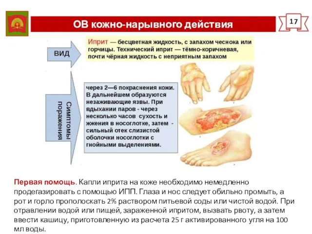 ОВ кожно-нарывного действия 17 Первая помощь. Капли иприта на коже