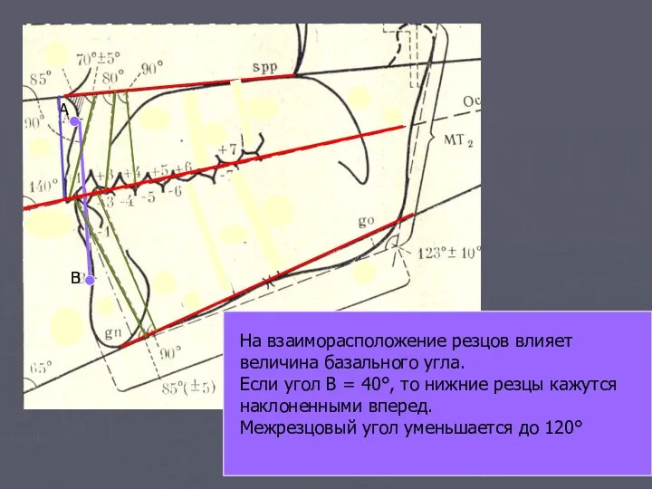 А В На взаиморасположение резцов влияет величина базального угла. Если