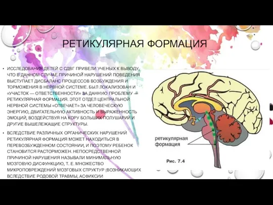 РЕТИКУЛЯРНАЯ ФОРМАЦИЯ ИССЛЕДОВАНИЯ ДЕТЕЙ С СДВГ ПРИВЕЛИ УЧЕНЫХ К ВЫВОДУ,