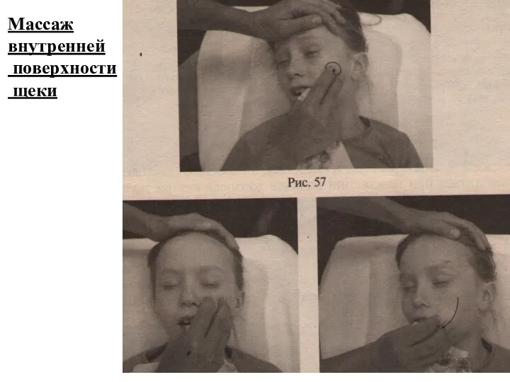 Массаж внутренней поверхности щеки