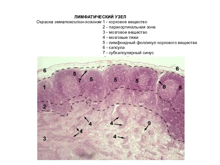 ЛИМФАТИЧЕСКИЙ УЗЕЛ Окраска гематоксилин-эозином 1 - корковое вещество 2 -