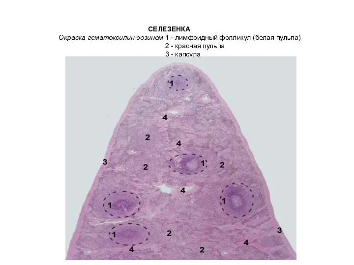 СЕЛЕЗЕНКА Окраска гематоксилин-эозином 1 - лимфоидный фолликул (белая пульпа) 2