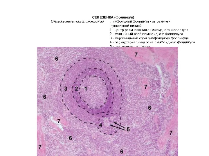 СЕЛЕЗЕНКА (фолликул) Окраска гематоксилин-эозином лимфоидный фолликул - отграничен пунктирной линией