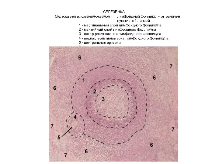 СЕЛЕЗЕНКА Окраска гематоксилин-эозином лимфоидный фолликул - отграничен пунктирной линией 1