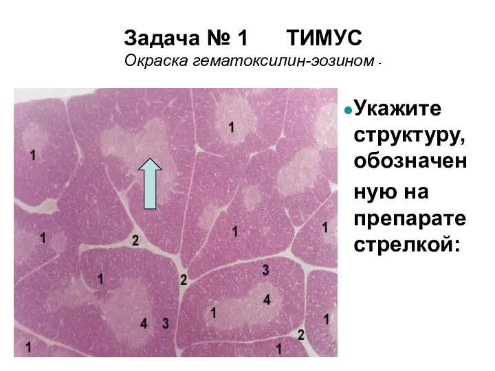 Задача № 1 ТИМУС Окраска гематоксилин-эозином - Укажите структуру, обозначен ную на препарате стрелкой: