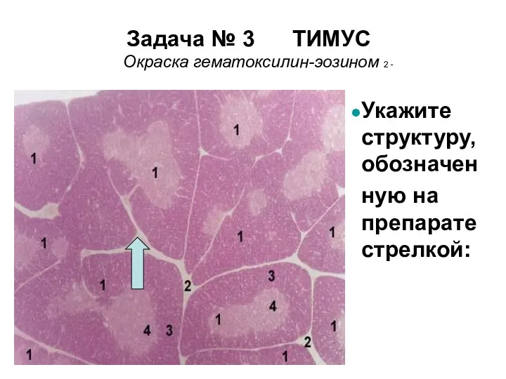 Задача № 3 ТИМУС Окраска гематоксилин-эозином 2 - Укажите структуру, обозначен ную на препарате стрелкой: