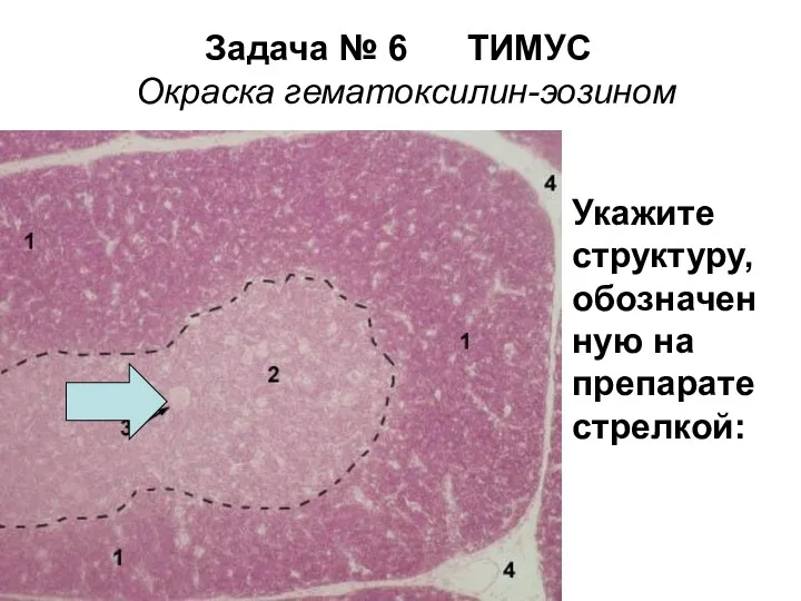 Задача № 6 ТИМУС Окраска гематоксилин-эозином Укажите структуру, обозначен ную на препарате стрелкой: