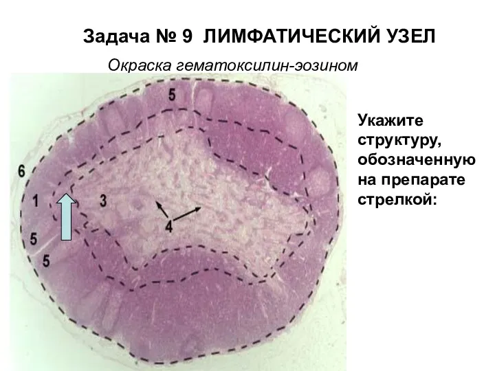 Задача № 9 ЛИМФАТИЧЕСКИЙ УЗЕЛ Окраска гематоксилин-эозином Укажите структуру, обозначенную на препарате стрелкой: