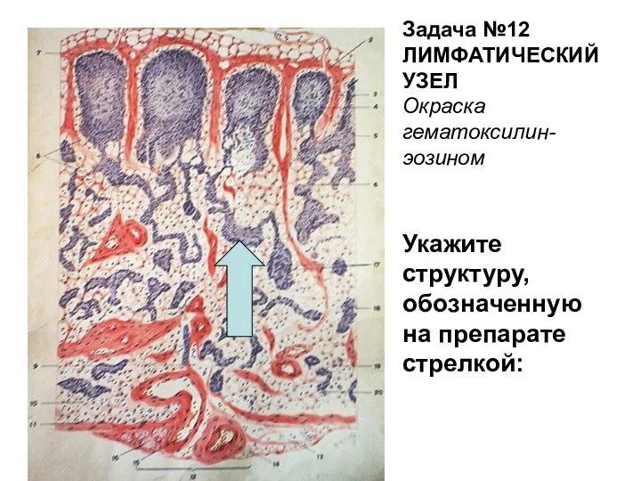 Задача №12 ЛИМФАТИЧЕСКИЙ УЗЕЛ Окраска гематоксилин-эозином Укажите структуру, обозначенную на препарате стрелкой: