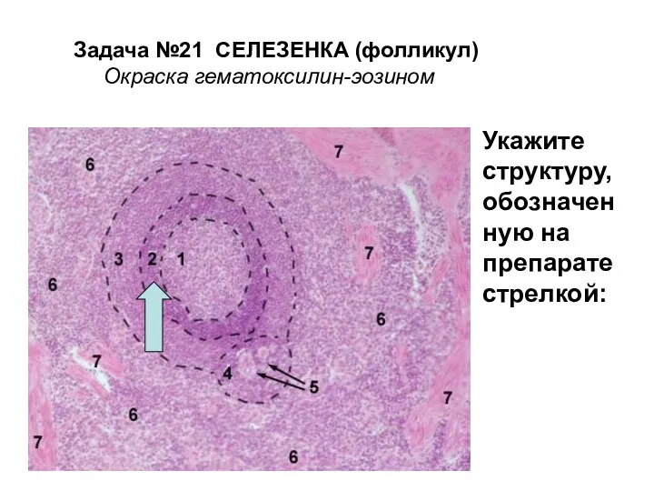 Задача №21 СЕЛЕЗЕНКА (фолликул) Окраска гематоксилин-эозином Укажите структуру, обозначен ную на препарате стрелкой: