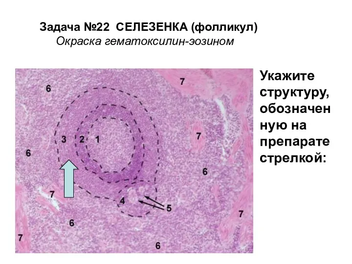 Задача №22 СЕЛЕЗЕНКА (фолликул) Окраска гематоксилин-эозином Укажите структуру, обозначен ную на препарате стрелкой: