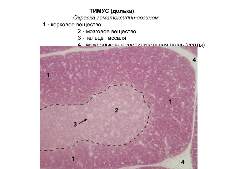 ТИМУС (долька) Окраска гематоксилин-эозином 1 - корковое вещество 2 -