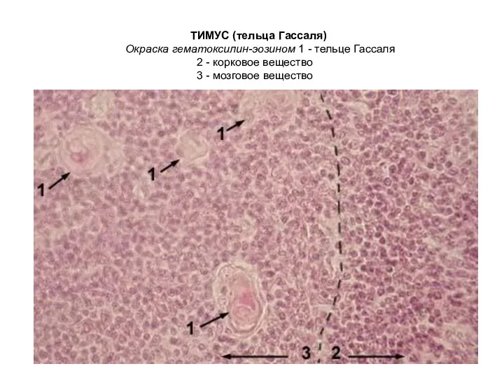 ТИМУС (тельца Гассаля) Окраска гематоксилин-эозином 1 - тельце Гассаля 2