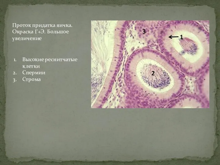 Проток придатка яичка. Окраска Г+Э. Большое увеличение Высокие реснитчатые клетки Спермии Строма
