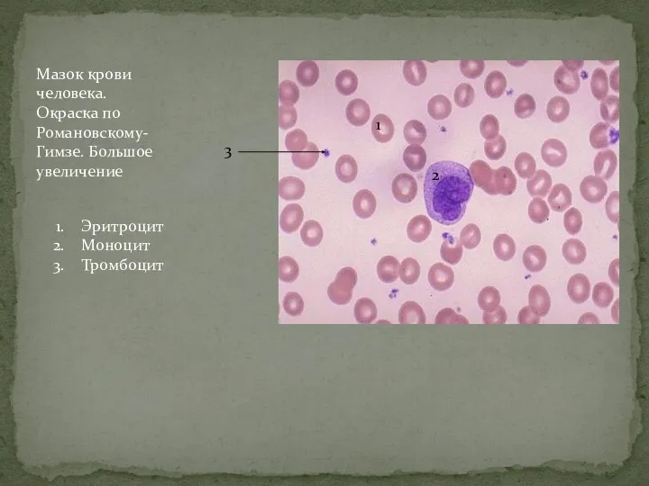 Мазок крови человека. Окраска по Романовскому-Гимзе. Большое увеличение 1 2 3 Эритроцит Моноцит Тромбоцит