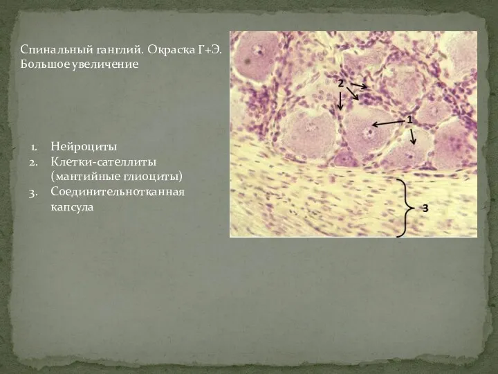 Спинальный ганглий. Окраска Г+Э. Большое увеличение Нейроциты Клетки-сателлиты (мантийные глиоциты) Соединительнотканная капсула