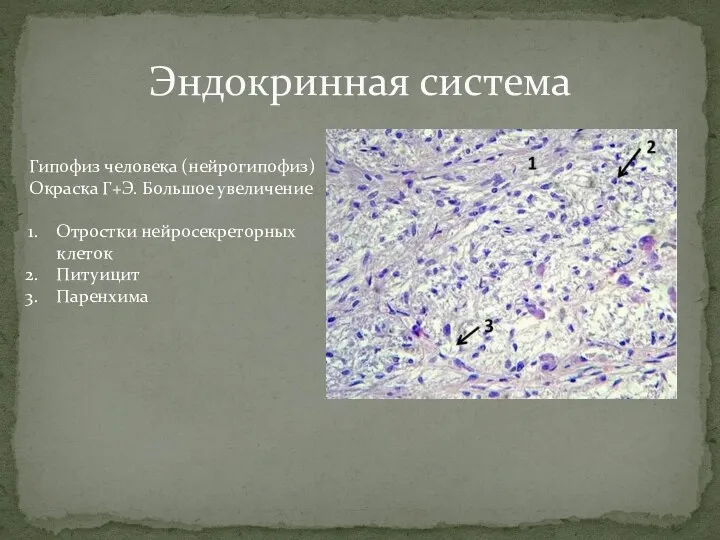 Эндокринная система Гипофиз человека (нейрогипофиз) Окраска Г+Э. Большое увеличение Отростки нейросекреторных клеток Питуицит Паренхима